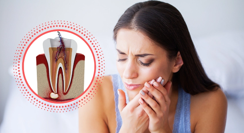 what happens if you skip the root canal