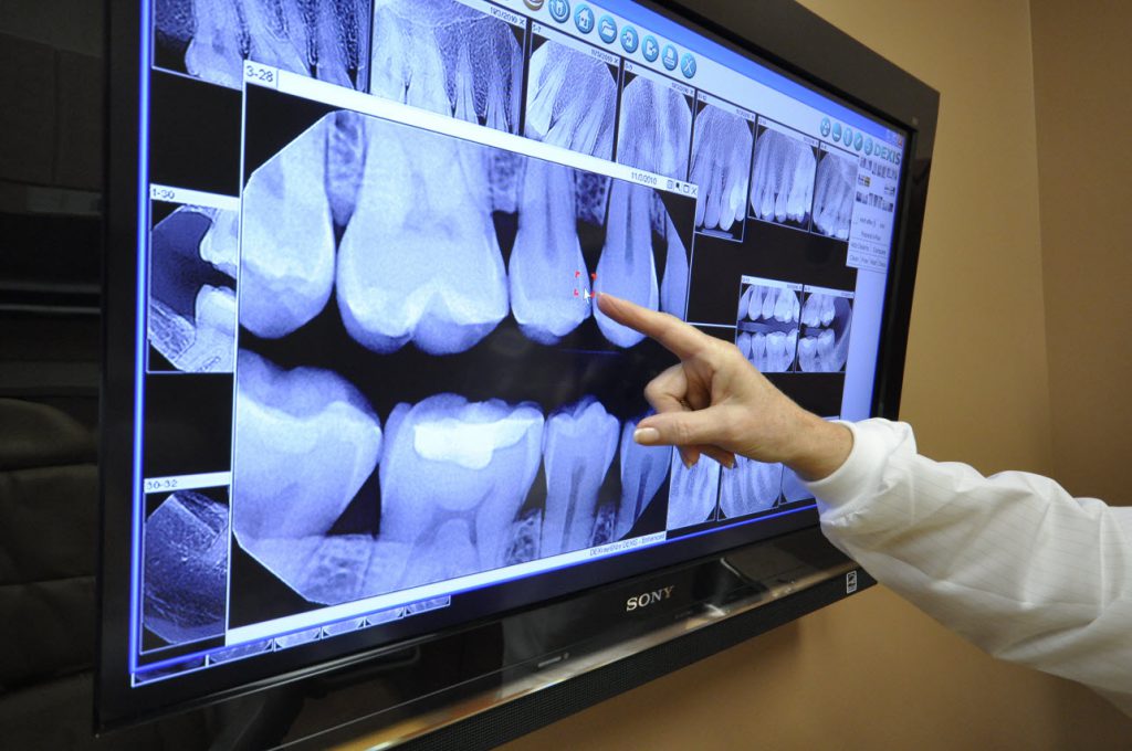 why digital dental xrays matter for better dental diagnosis