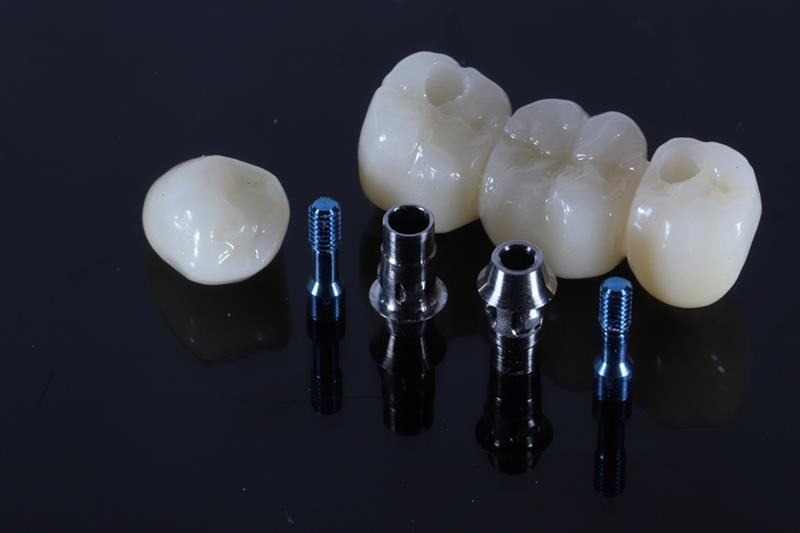 dental crowns and bridges parkdale