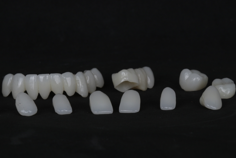 what's the difference between a crown and a bridge, and how long do they last