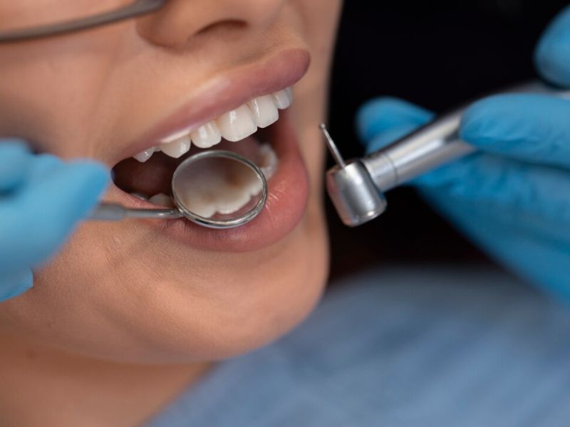 dental crowns after root canal treatment why they're important
