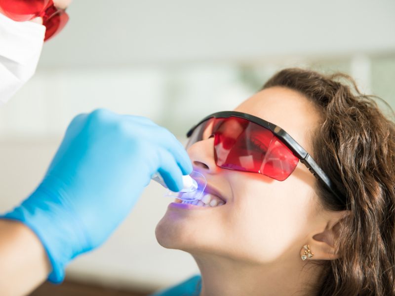 does professional teeth whitening work better than at home